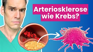 Arteriosklerose  eine tumorartige Erkrankung  Dr Waller erklärt [upl. by Gaye73]