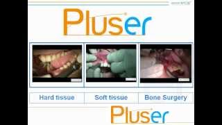 Doctor Smile Dental Lasers  Pluser Erbium laser [upl. by Gamaliel]