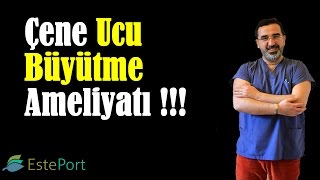 Çene Ucu Büyütme Ameliyatı amp Op Dr Ali Mezdeği [upl. by Ieluuk]