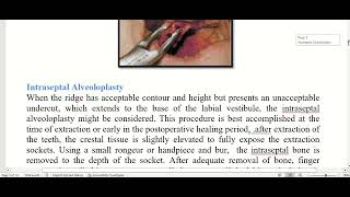 preprosthetic surgical considrations [upl. by Kinney]