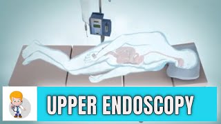 Upper GI endoscopy Esophagogastroduodenoscopy Animation 3D [upl. by Orteip]