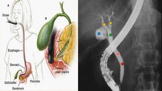 Imaging of Hepatobiliary Systems  Radiology [upl. by Otsugua]