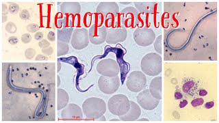 Hemoparasites pathology pathologylab hematology smear parasite [upl. by Cleodal513]