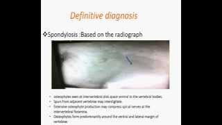 Spondylosis deformans [upl. by Laidlaw589]