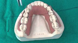 Peridontal Suturing Techniques [upl. by Birk59]