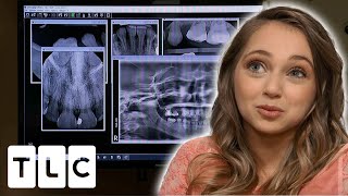 22YearOld Woman Still Has Her Baby Teeth  I am Shauna Rae [upl. by Emirej436]