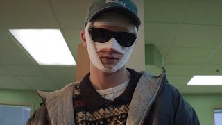 His Lethally Attractive Looks Forced Him to Cover His Face With Bandages  Movie Recap [upl. by Nashom]