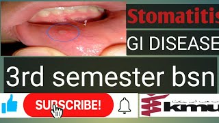 stomatitisGastrointestinal disease 1 stomatitisKMU BSN 3rd semester AHN types of stomatitis [upl. by Dituri466]