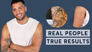 Laser Tattoo Removal  Real People True Results 2023 [upl. by Fredella619]