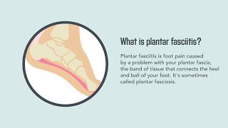 Plantar Fasciitis Causes Symptoms and Treatment  Merck Manual Consumer Version [upl. by Roth]