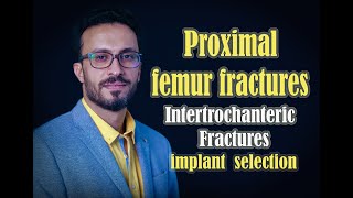 06 Proximal femur Intertrochanteric fractures Implant selection [upl. by Itnaihc]