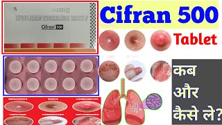 Cifran 500 Tablet Use Dose Sideeffects Precautions And Review [upl. by Ellingston31]