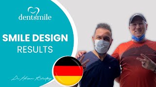 DentSmile Dental Clinic Patient Review Videos Sunay German Lächeln Design DtHasan Karatay [upl. by Helaine]