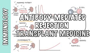 Transplant Medicine  Antibody mediated rejection [upl. by Adachi]