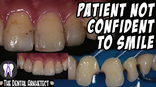 Bringing Back His Confidence Tooth Filling Replaced Middle Part is the Best 4K C16 [upl. by Grubman]