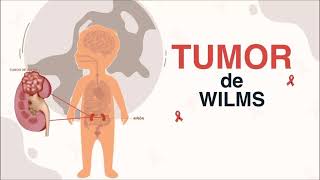 TUMOR DE WILMS [upl. by Katinka]