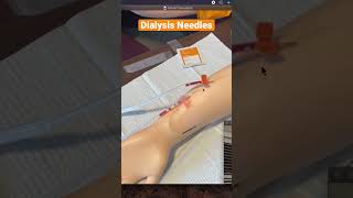 Mastering Dialysis  Learn How To Insert Needles For AV Fistula [upl. by Bueschel]