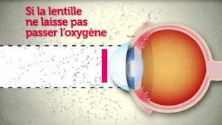 Lentilles de contact  attention les yeux [upl. by Mendelsohn]