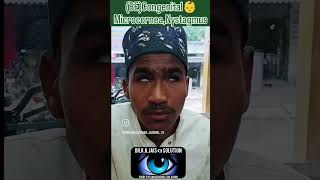 BECONGENITAL MICROCORNEA  NYSTAGMUS eyetreatment eyedoctor eyecondition DrAanchalMD [upl. by Rosabel946]