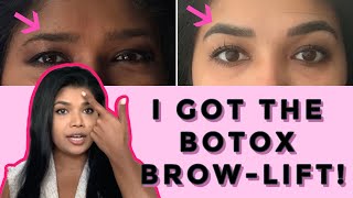 Getting Botox  Brow Lift  Before amp After VLOG [upl. by Llovera]