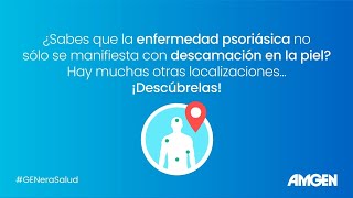 Descubre las diferentes localizaciones de la enfermedad psoriásica [upl. by Loss562]