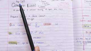 CataractSenile CataractPART 1 theory exam notes AK KHURANA [upl. by Shulins]