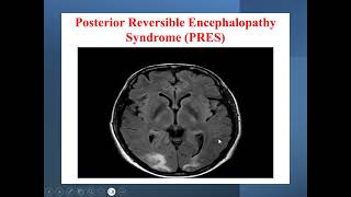 Renal Cases  Revision part 2 [upl. by Naes]