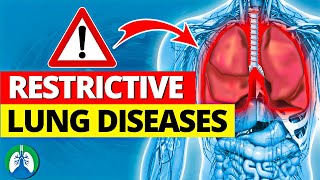 Top 13 Restrictive Lung Diseases to Know  Listed and Explained [upl. by Annuhsal]