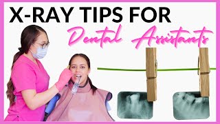 HOW TO TAKE DENTAL XRAYS  Tips for Dental Assistants [upl. by Yralih]