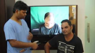 DHT Hair Transplant in Delhi Hair Transplant Cost Hair Transplant Review [upl. by Akinahs]