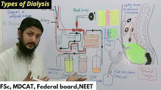 hemodialysis and peritoneal dialysis  types of dialysis [upl. by Sargent]