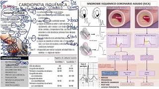 6 CARDIOPATIA ISQUEMICA DIAGNOSTICO [upl. by Aital756]