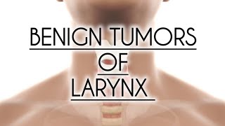 BENIGN TUMORS OF LARYNX PAPILLOMA HEMANGIOMA FIBROMA [upl. by Assilat]