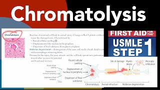 Chromatolysis Wallerian degeneration Axonal regeneration in HindiUrdu by first aid forUSMLE step1 [upl. by Macmahon]