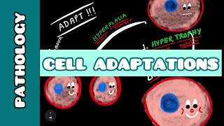 Cell Adaptation  Pathology  Ayan Parichha [upl. by Rettke521]