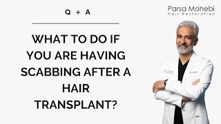 Scabbing After an FUE Hair Transplant [upl. by Esile847]