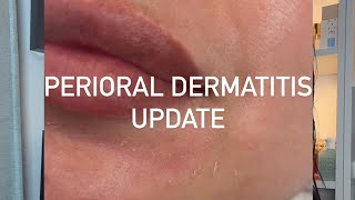 Morning Skincare  Perioral Dermatitis Update [upl. by Ania417]