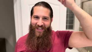 How To Get Rid Of DandruffBeardruff  Strategies For Hair AND Beard [upl. by Tu]