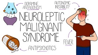 Neuroleptic Malignant Syndrome NMS Explained [upl. by Aicina313]