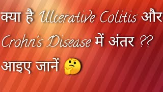 Ulcerative Colitis Versus Crohns Disease in Hindi Language [upl. by Moises]