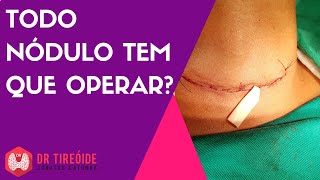 7 DOENÇAS CAUSADAS PELA TIREOIDE Hipotireoidismo e Hipertireoidismo [upl. by Sachs]