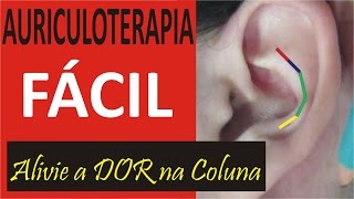 Auriculoterapia Nas Algias Vertebrais Aprenda Grátis Auriculoterapia [upl. by Nesmat]