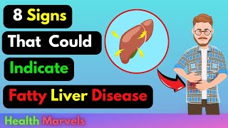 Top 8 Fatty Liver Symptoms You Must Know  Warning Signs amp Causes [upl. by Ponzo]