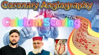 Ct Coronary Angiography  Ct Calcium Scoring Ct Cardiac Angiography  Angiogram  Angio viral [upl. by Bhayani800]