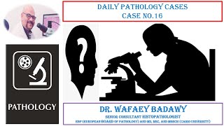 DAILY PATHOLOGY CASES CASE NO 16 BY DR WAFAEY BADAWY [upl. by Ylurt]