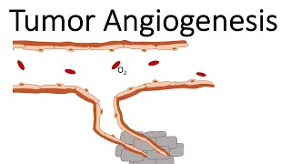 Tumor Angiogenesis [upl. by Mcquillin388]