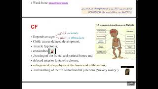 MBD4osteoporosis and osteomalacia [upl. by Michail444]