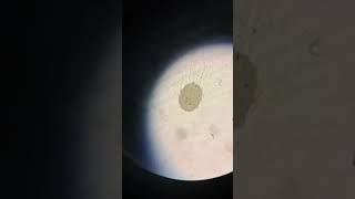 Ascaris lumbricoides fertilized eggmedicoaanchal03 neet mbbs microbiology shorts biology [upl. by Ydnic]