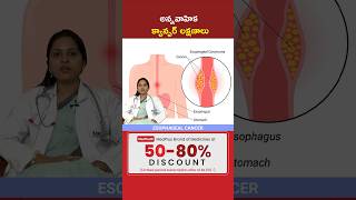 Esophageal Cancer Symptoms in 30 Sec l Dr Jyothi Jonnadula shorts MedPlusONETV [upl. by Joshi]