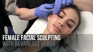 Live Female Facial Sculpting with Revanesse Versa Filler by Dr Jason Emer  Before amp After Result [upl. by Boggs704]